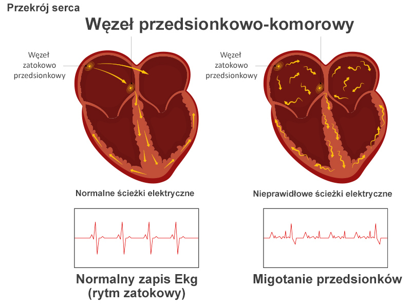 Prawidlowa praca serca oraz arytmia