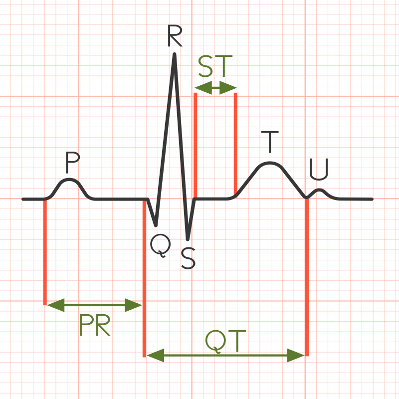 qrs odcinek qt