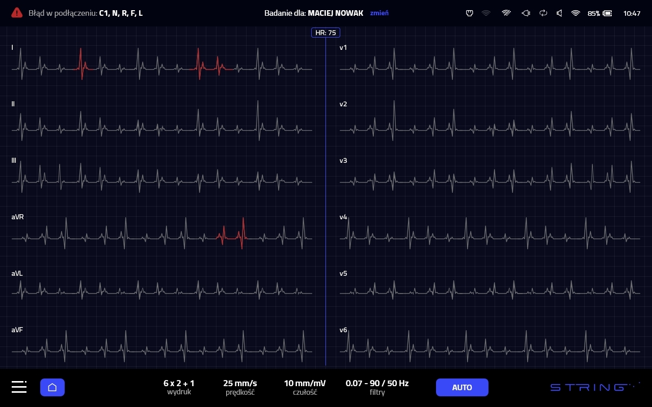 aparat_ekg_string